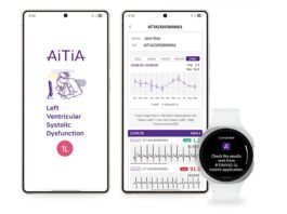 Detección Pionera de Insuficiencia Cardíaca en Smartwatch Samsung con IA Avanzada