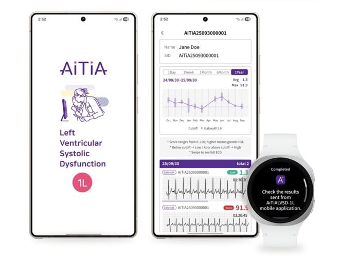 Detección Pionera de Insuficiencia Cardíaca en Smartwatch Samsung con IA Avanzada