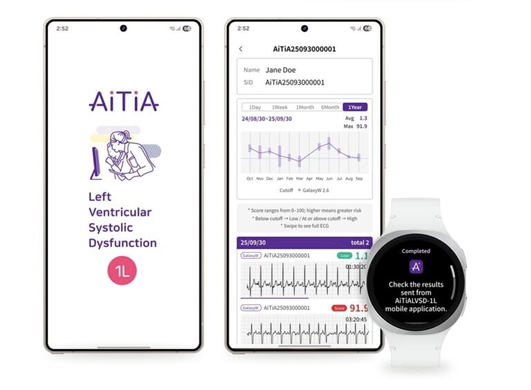 Detección Pionera de Insuficiencia Cardíaca en Smartwatch Samsung con IA Avanzada